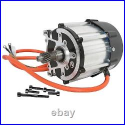 72V 1500W Brushless Differential Motor for Electric Bike Tricycle Golf Cart Quad