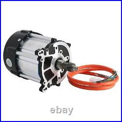 72V 1500W High Speed Brushless Differential Motor fo Electric Bike Quad ATV Cart